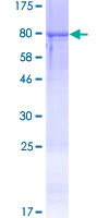 ab160186 on a 12.5% SDS-PAGE stained with Coomassie Blue.