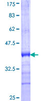 ab160187 on a 12.5% SDS-PAGE stained with Coomassie Blue.