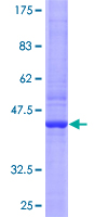 ab159345 on a 12.5% SDS-PAGE stained with Coomassie Blue.