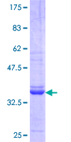 ab159347 on a 12.5% SDS-PAGE stained with Coomassie Blue.