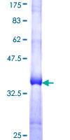 ab162013 on a 12.5% SDS-PAGE stained with Coomassie Blue.