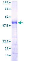 ab163834 on a 12.5% SDS-PAGE stained with Coomassie Blue.