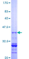 ab160106 on a 12.5% SDS-PAGE stained with Coomassie Blue.