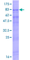 ab161916 on a 12.5% SDS-PAGE stained with Coomassie Blue.