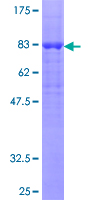 ab160584 on a 12.5% SDS-PAGE stained with Coomassie Blue.