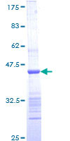 ab160585 on a 12.5% SDS-PAGE stained with Coomassie Blue.
