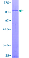 ab159342 on a 12.5% SDS-PAGE stained with Coomassie Blue.