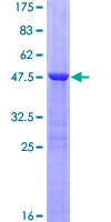ab164750 on a 12.5% SDS-PAGE stained with Coomassie Blue.