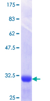 ab164751 on a 12.5% SDS-PAGE stained with Coomassie Blue.