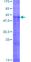 ab159348 on a 12.5% SDS-PAGE stained with Coomassie Blue.