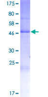 ab163548 on a 12.5% SDS-PAGE stained with Coomassie Blue.