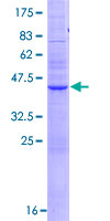ab162899 on a 12.5% SDS-PAGE stained with Coomassie Blue.