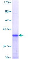 ab162900 on a 12.5% SDS-PAGE stained with Coomassie Blue.