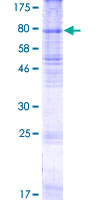 ab162563 on a 12.5% SDS-PAGE stained with Coomassie Blue.