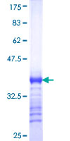 ab162564 on a 12.5% SDS-PAGE stained with Coomassie Blue.