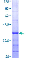 ab165172 on a 12.5% SDS-PAGE stained with Coomassie Blue.