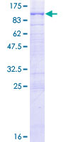 ab160698 on a 12.5% SDS-PAGE stained with Coomassie Blue.