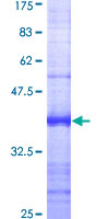 ab160699 on a 12.5% SDS-PAGE stained with Coomassie Blue.