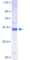 ab162763 on a 12.5% SDS-PAGE stained with Coomassie Blue.