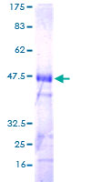 ab153447 on a 12.5% SDS-PAGE stained with Coomassie Blue.