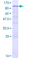 ab163047 on a 12.5% SDS-PAGE stained with Coomassie Blue.