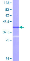 ab163048 on a 12.5% SDS-PAGE stained with Coomassie Blue.