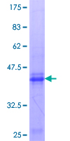 ab165708 on a 12.5% SDS-PAGE stained with Coomassie Blue.