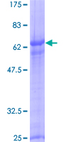 ab164608 on a 12.5% SDS-PAGE stained with Coomassie Blue.