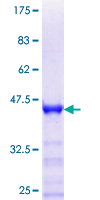 ab164609 on a 12.5% SDS-PAGE stained with Coomassie Blue.