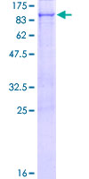 ab165047 on a 12.5% SDS-PAGE stained with Coomassie Blue.