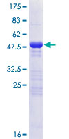 ab162768 on a 12.5% SDS-PAGE stained with Coomassie Blue.