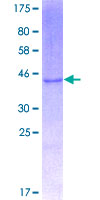 ab159354 on a 12.5% SDS-PAGE stained with Coomassie Blue.