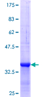ab159355 on a 12.5% SDS-PAGE stained with Coomassie Blue.