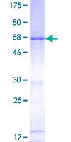 ab153099 on a 12.5% SDS-PAGE stained with Coomassie Blue.