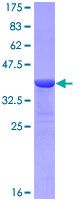 ab114504 analysed by 12.5% SDS-PAGE and stained with Coomassie Blue.