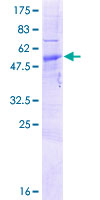 ab152900 on a 12.5% SDS-PAGE stained with Coomassie Blue.