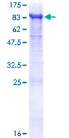 12.5% SDS-PAGE showing ab114914 at approximately 95.48kDa. Stained with Coomassie Blue.