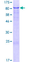 ab164047 on a 12.5% SDS-PAGE stained with Coomassie Blue.