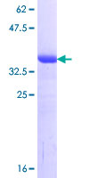 ab163734 on a 12.5% SDS-PAGE stained with Coomassie Blue.
