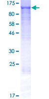 ab164749 on a 12.5% SDS-PAGE stained with Coomassie Blue.