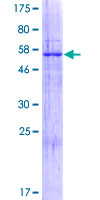 ab163569 on a 12.5% SDS-PAGE stained with Coomassie Blue.