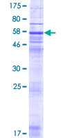 ab166206 on a 12.5% SDS-PAGE stained with Coomassie Blue.