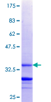 ab166207 on a 12.5% SDS-PAGE stained with Coomassie Blue.