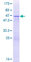 ab163858 on a 12.5% SDS-PAGE stained with Coomassie Blue.