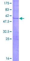 ab163859 on a 12.5% SDS-PAGE stained with Coomassie Blue.