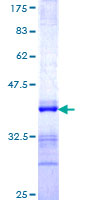 ab163860 on a 12.5% SDS-PAGE stained with Coomassie Blue.