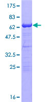 ab159360 on a 12.5% SDS-PAGE stained with Coomassie Blue.