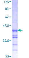ab159361 on a 12.5% SDS-PAGE stained with Coomassie Blue.