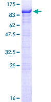 ab164432 on a 12.5% SDS-PAGE stained with Coomassie Blue.