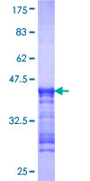 ab164433 on a 12.5% SDS-PAGE stained with Coomassie Blue.